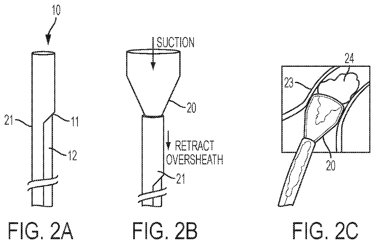 Systems and Methods for Removing Undesirable Material Within a Circulatory System