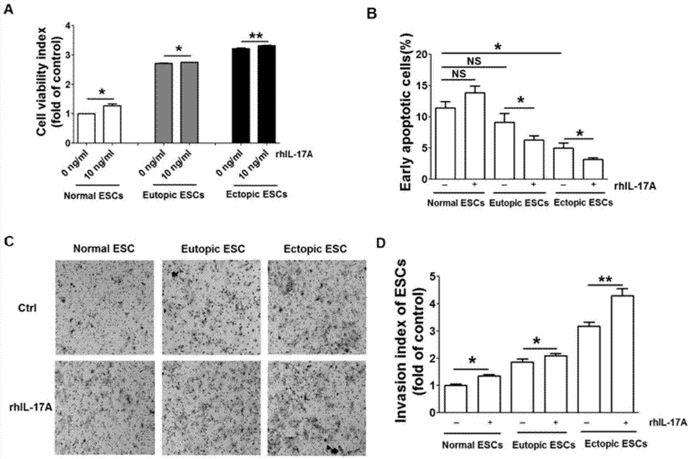 Application of interleukin antibodies to preparation of pharmaceutical composition for treating endometriosis