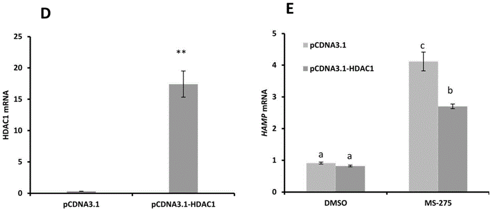 Application of HDAC1 inhibitor in preparing medicine for regulating and controlling hepcidin expression