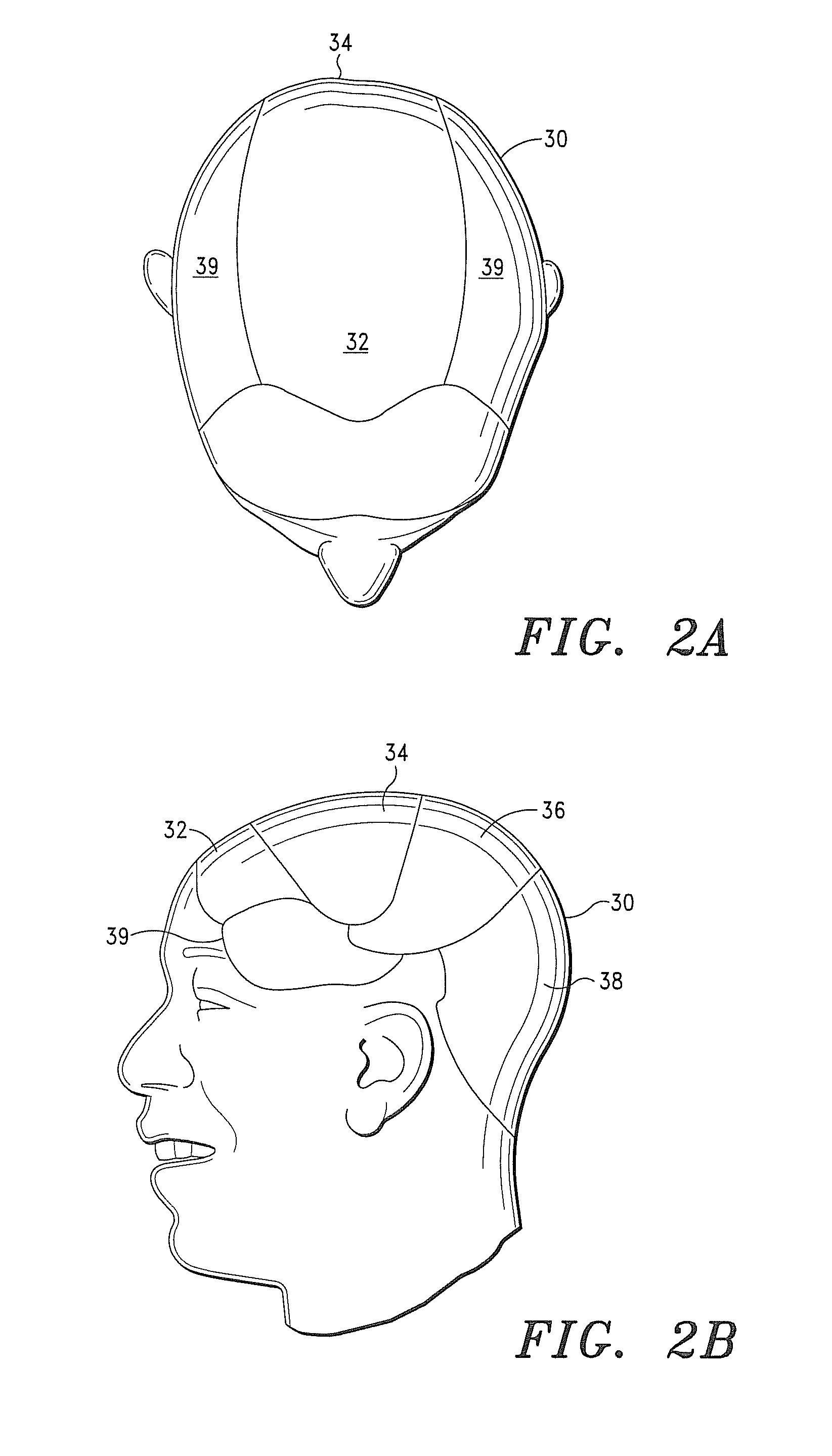 Systems, Compositions and Methods for the Treatment of Alopecia