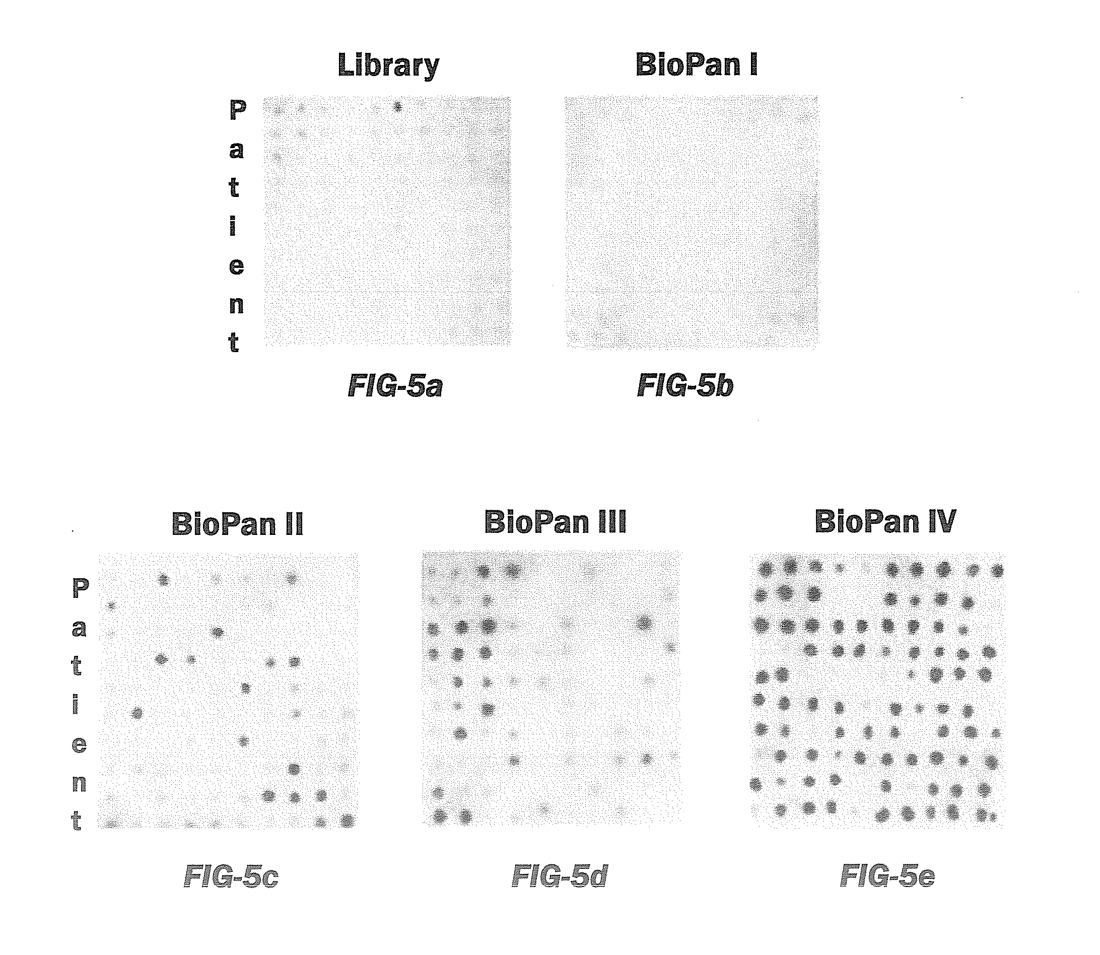 Neoepitope detection of disease using protein arrays