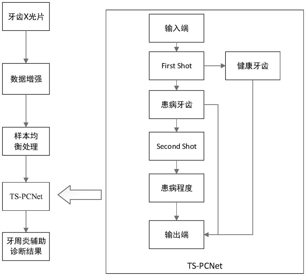 TS-PCNet-based panoramic X-ray film image classification method and system