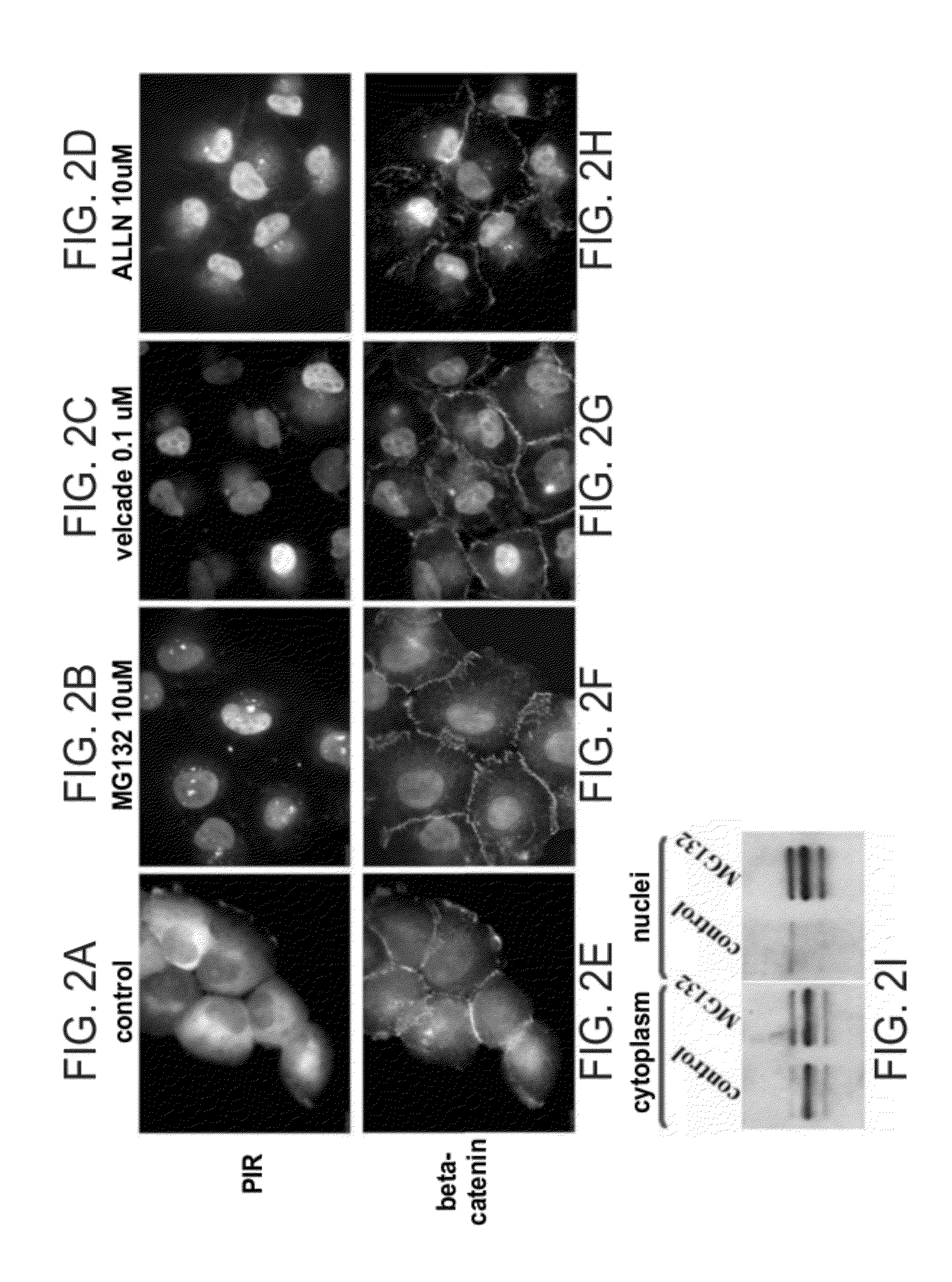 Proteasome inhibitors and uses thereof