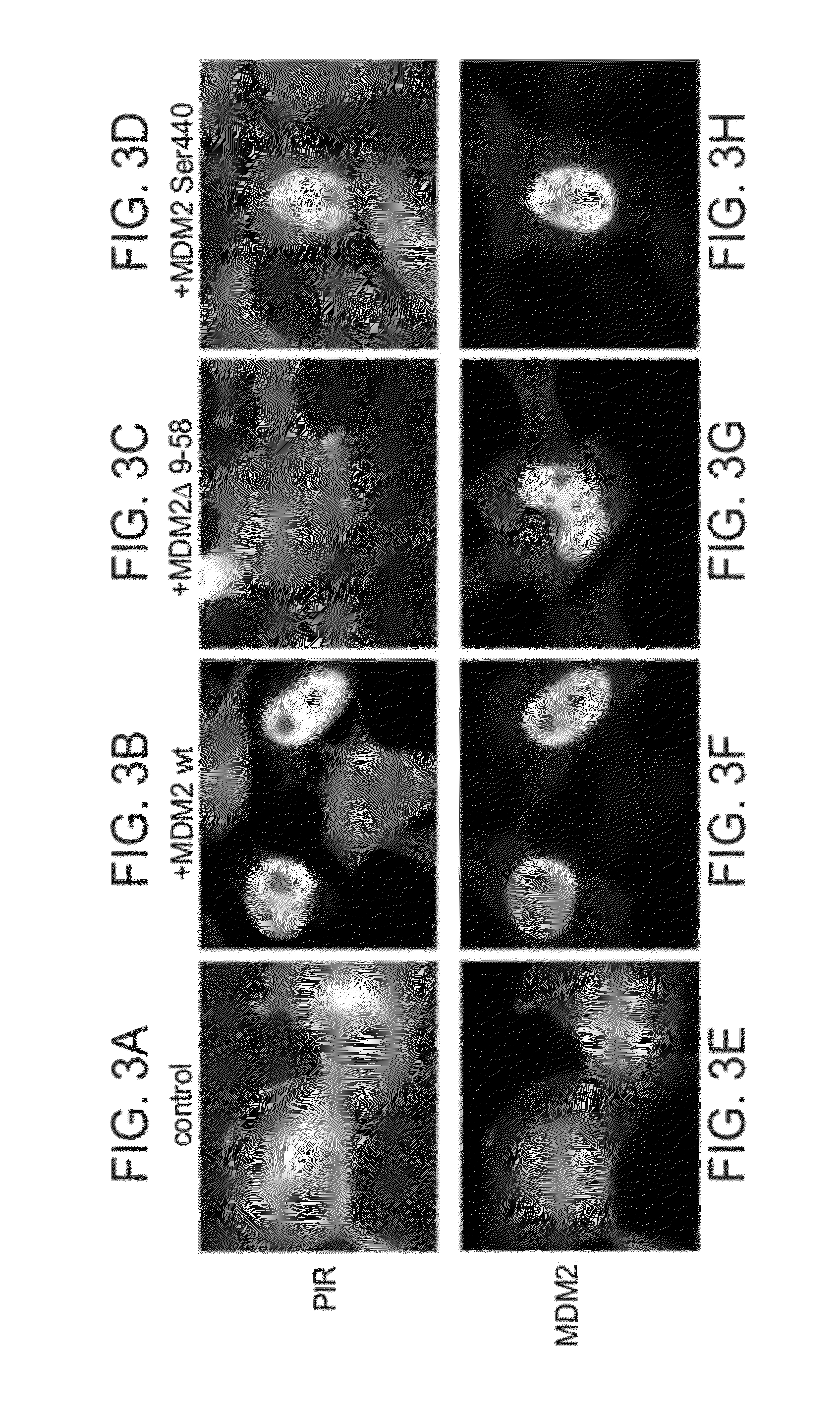 Proteasome inhibitors and uses thereof