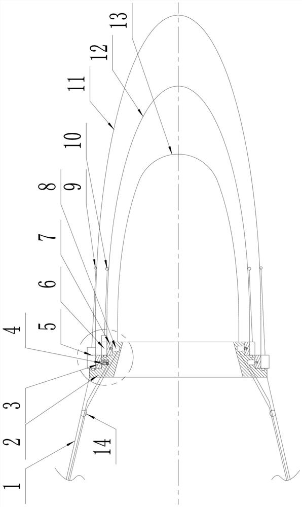 A nested detachable catch separation trawl mesh bag and its operation method