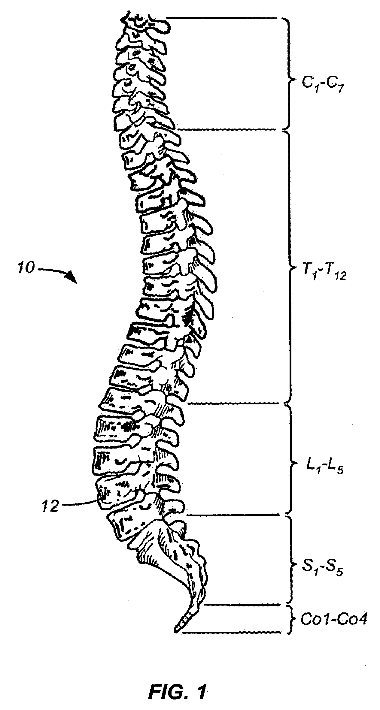 Percutaneous Devices for Separating Tissue, Kits and Methods of Using the Same