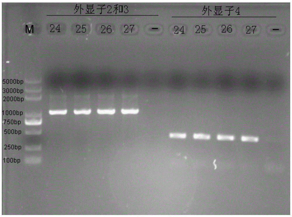 Kit and method for typing HLA gene