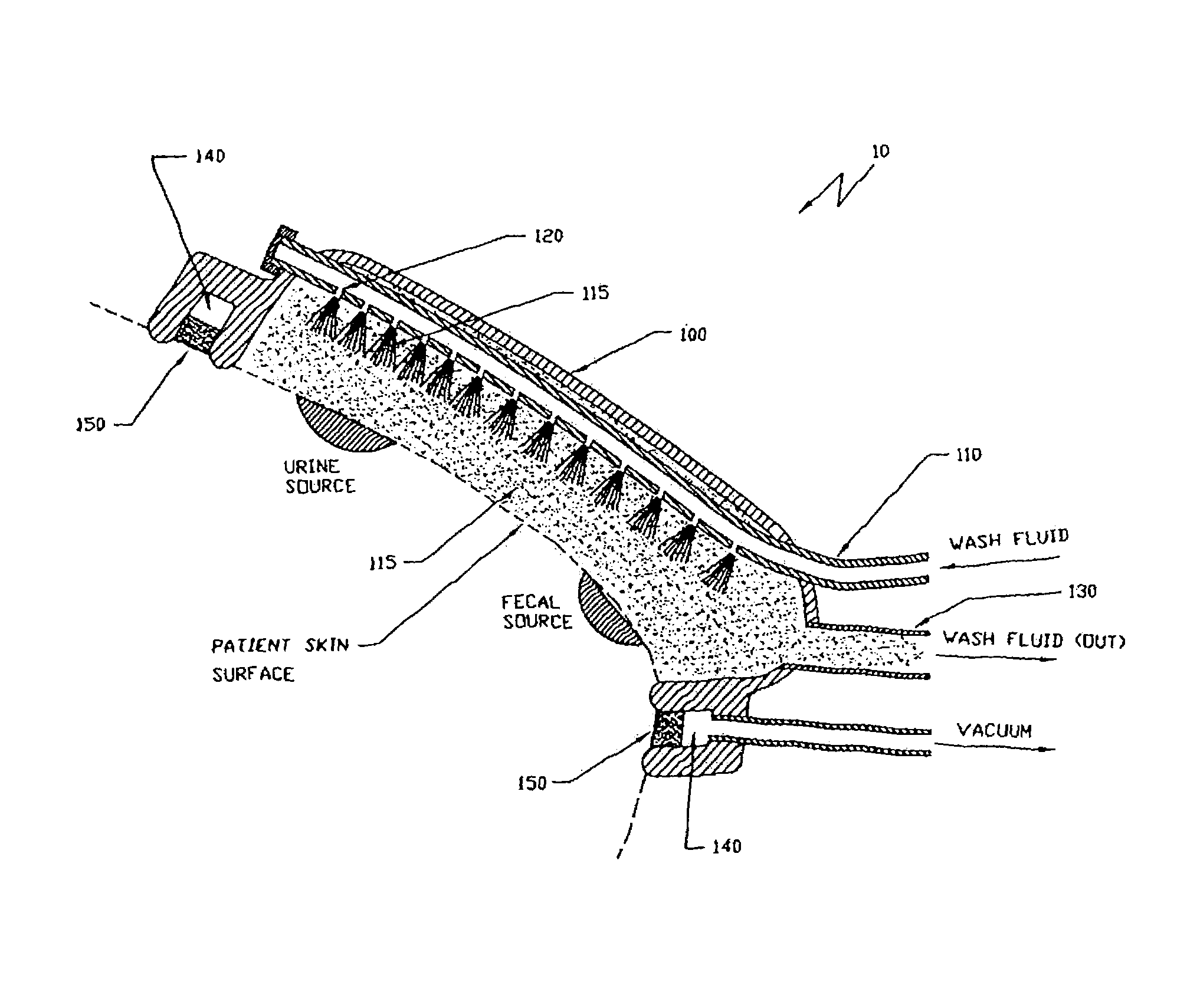 Apparatus and method for the removal and containment of human waste excretion
