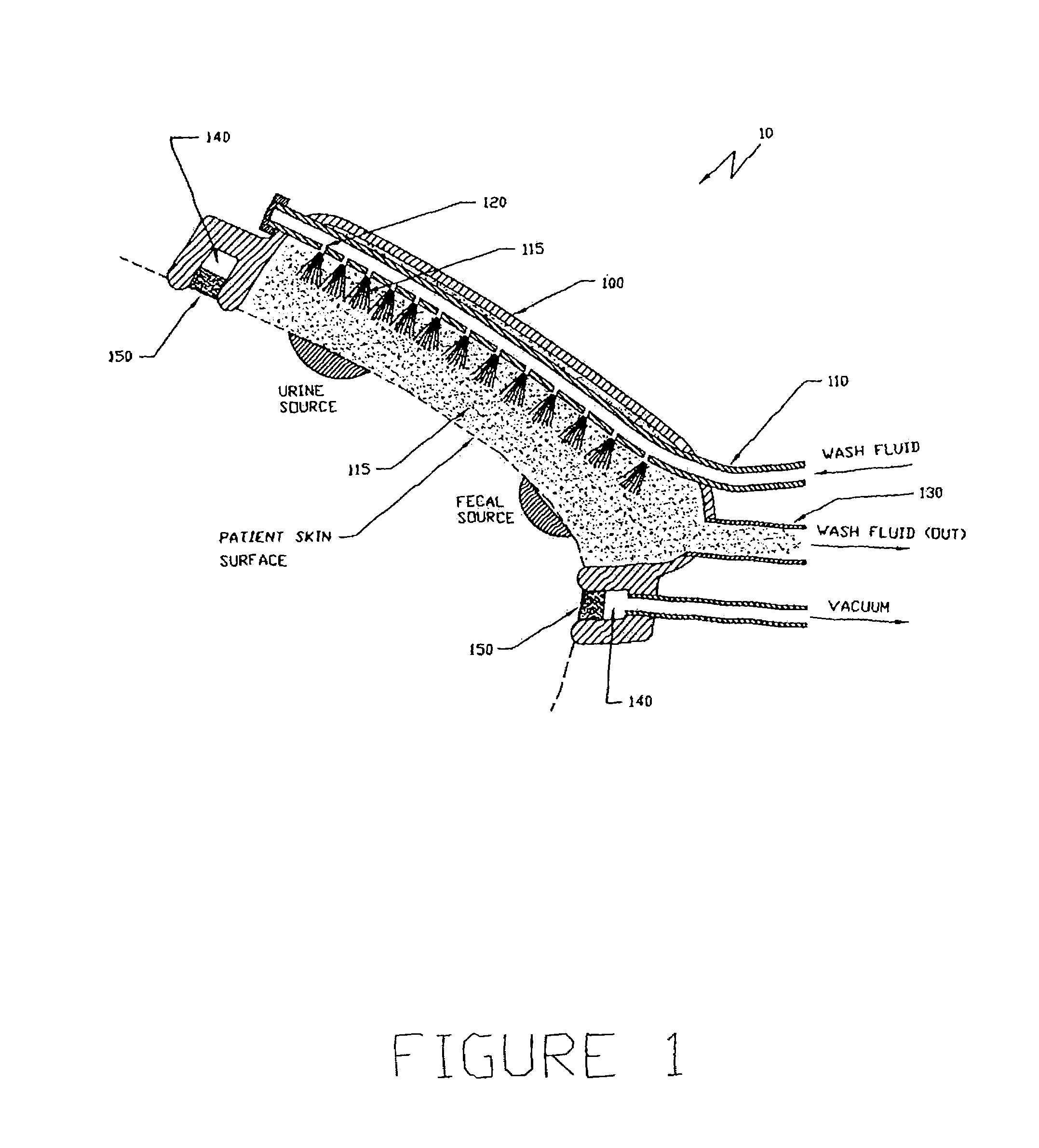 Apparatus and method for the removal and containment of human waste excretion