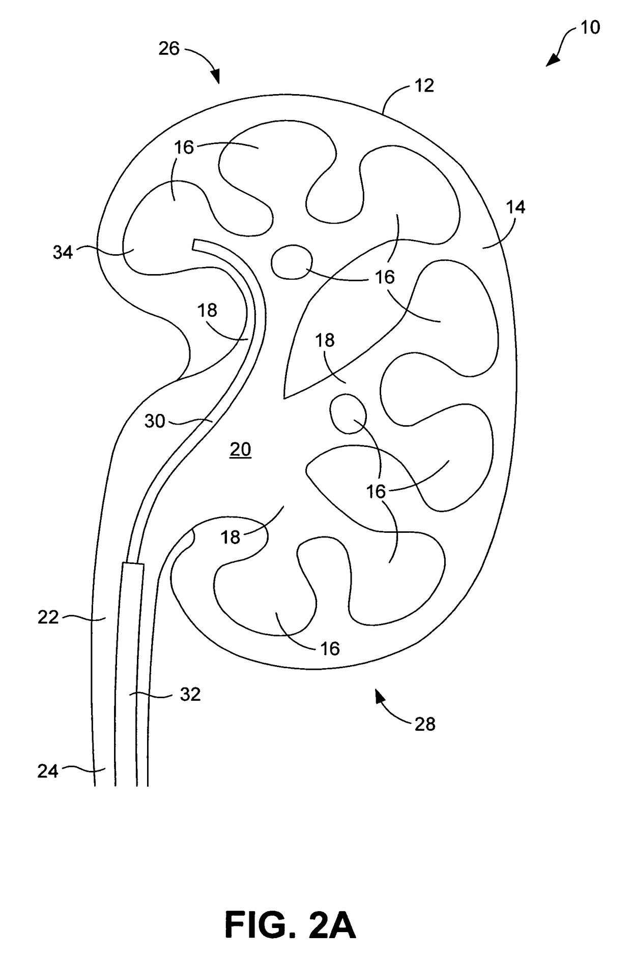 System and method for marking body cavities