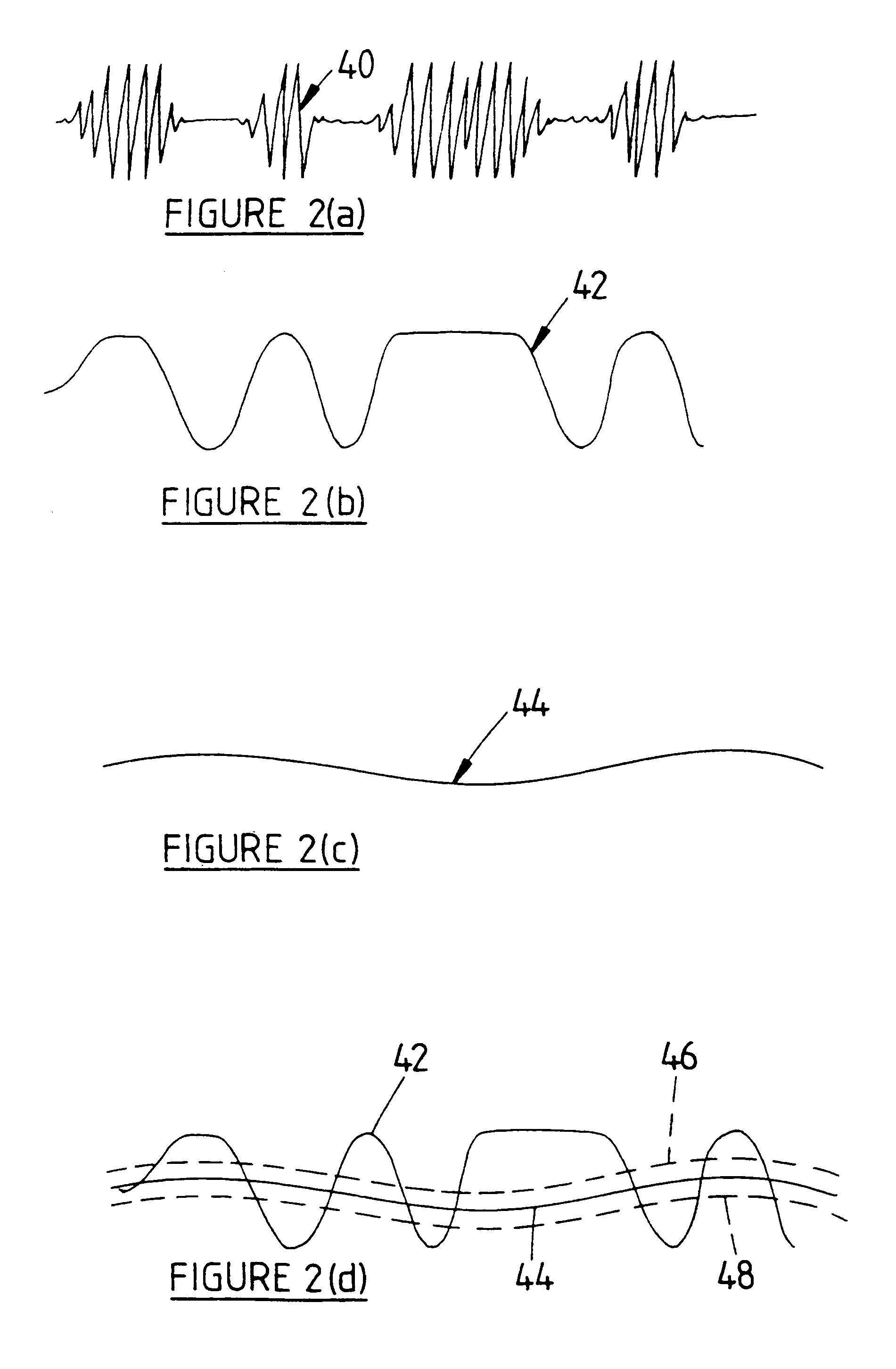Apparatus and method for detecting far end speech