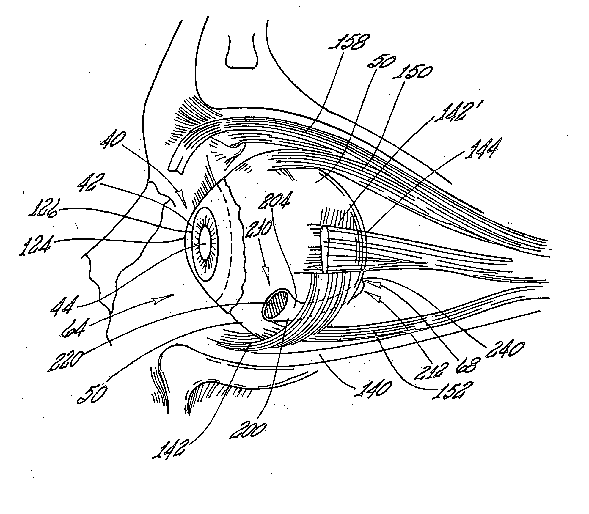 Implantable delivery device for administering pharmacological agents to an internal portion of a body