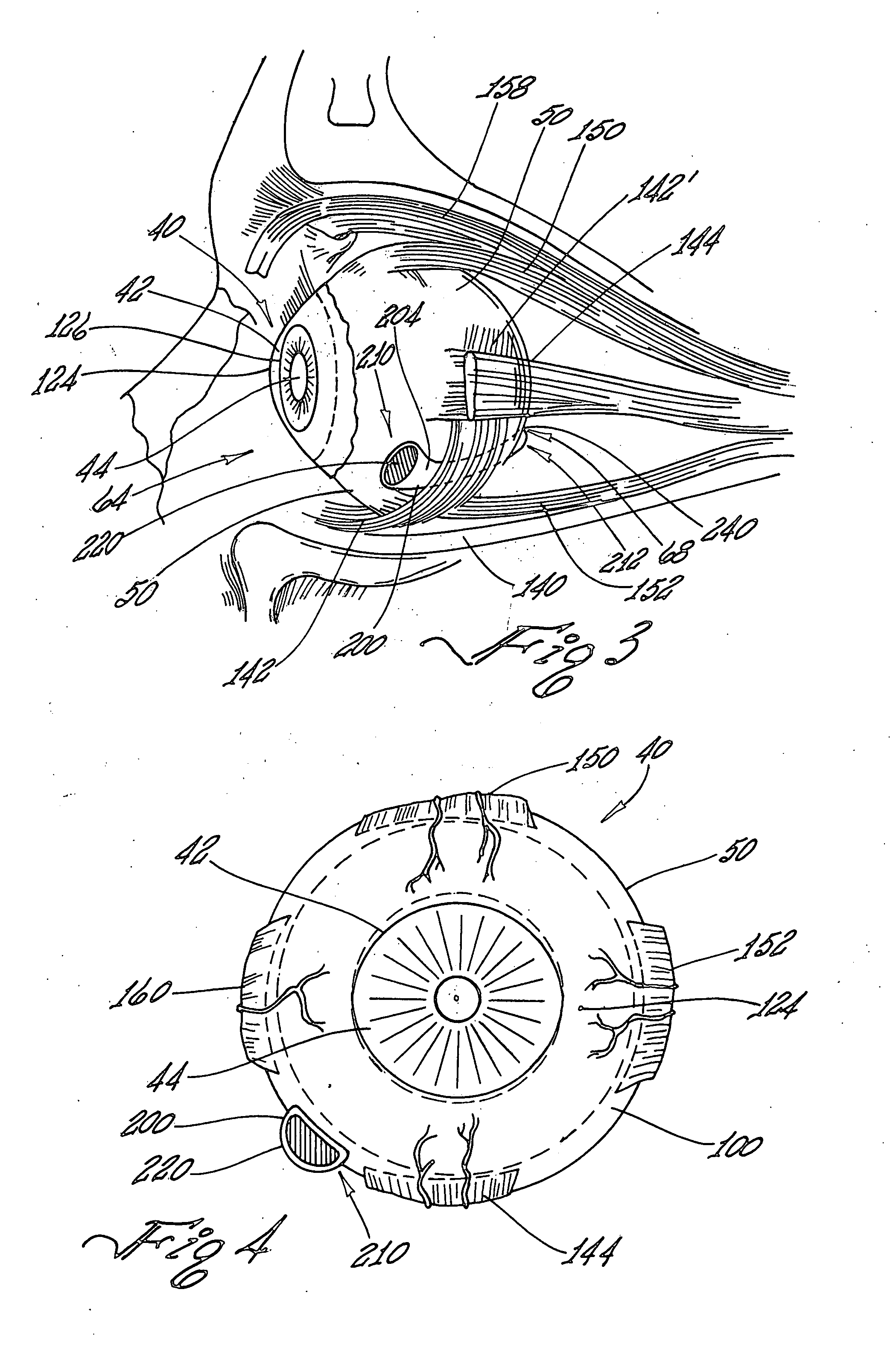 Implantable delivery device for administering pharmacological agents to an internal portion of a body