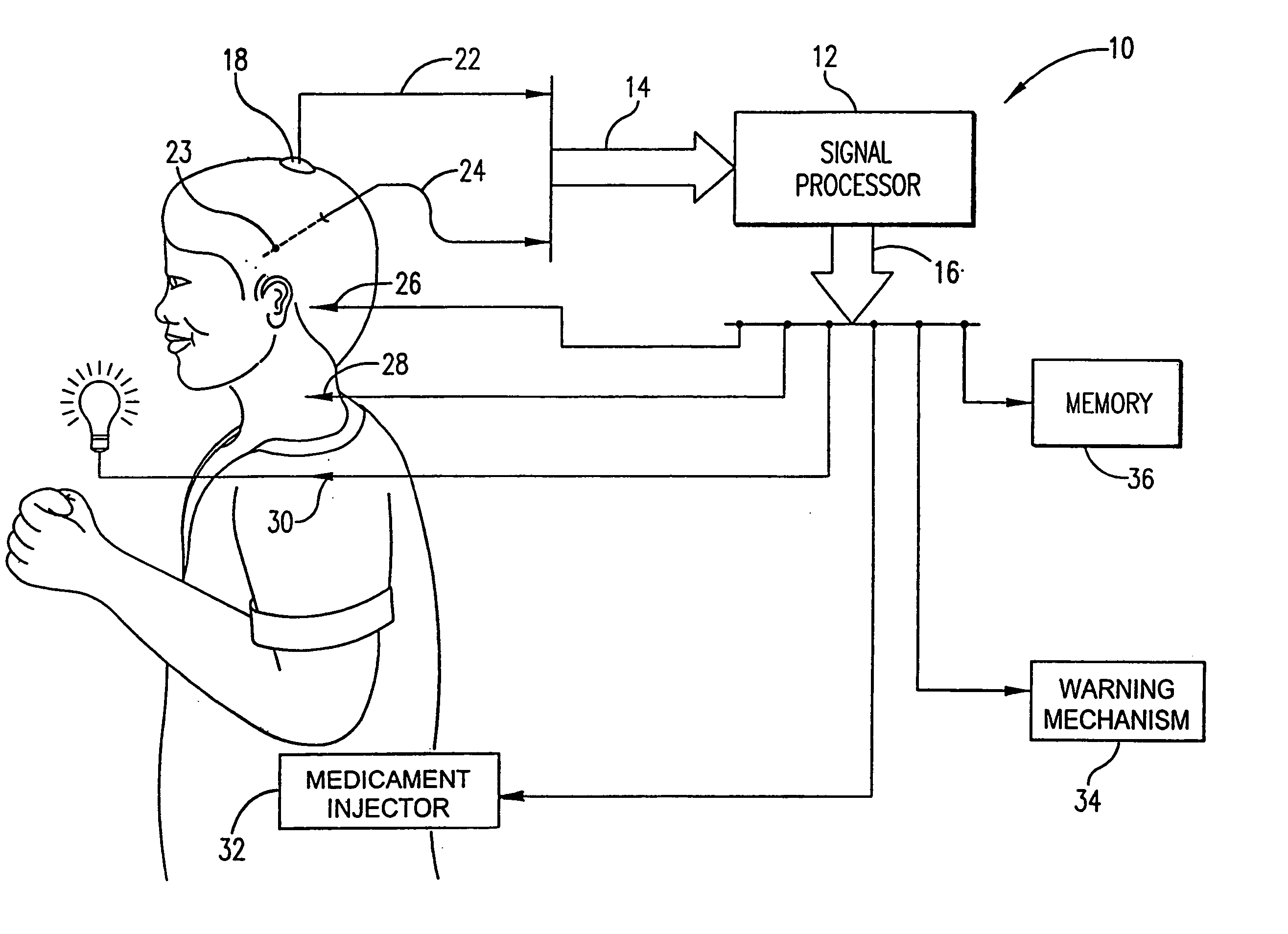 System for the prediction, rapid detection, warning, prevention, or control of changes in activity states in the brain of a subject