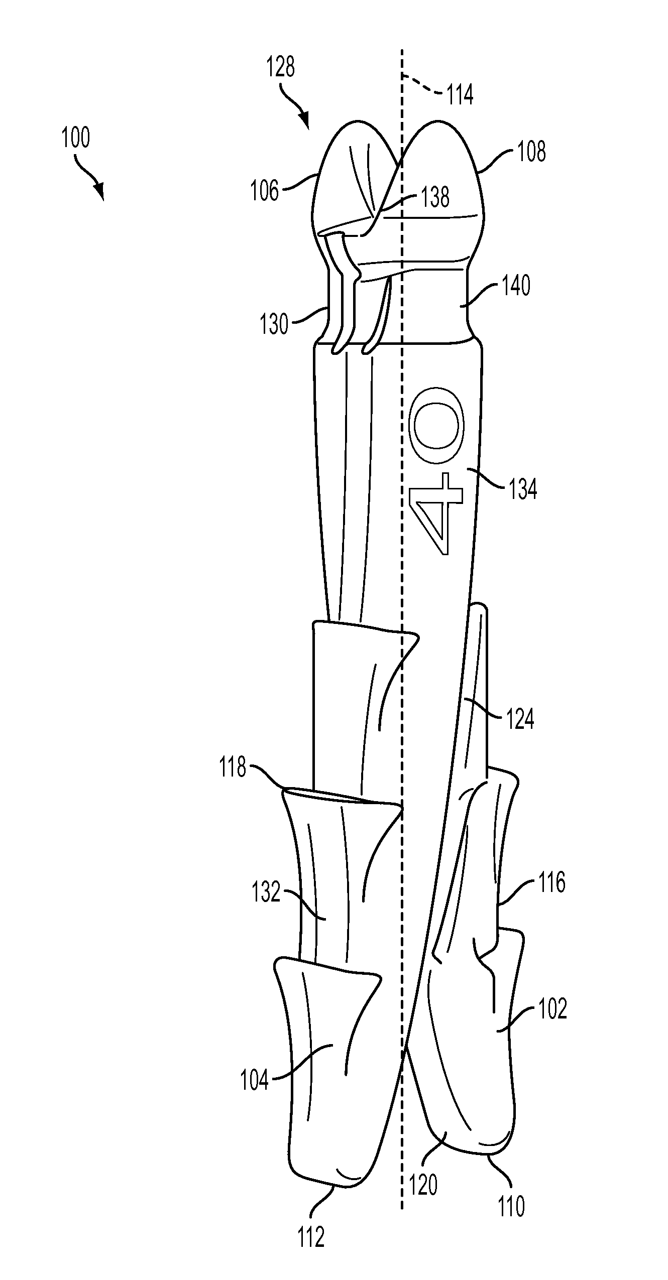 Revisable orthopedic anchor and methods of use