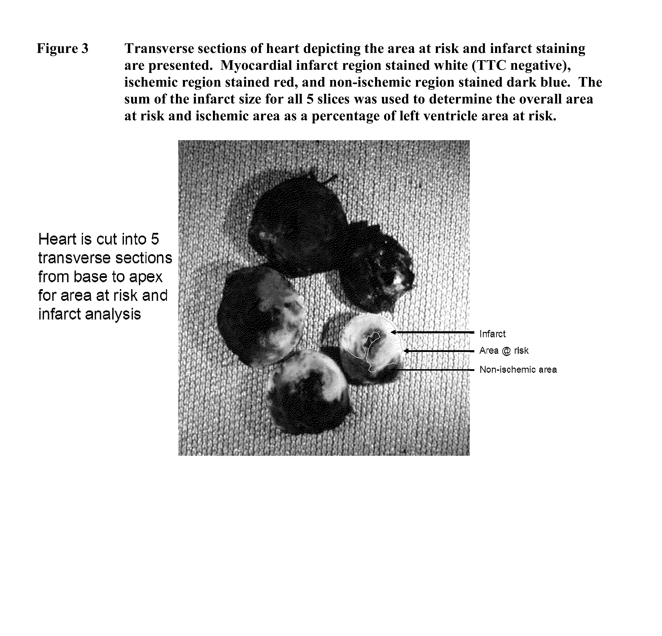 Methods for treating or preventing cardiovascular disorders and providing cardiovascular protection