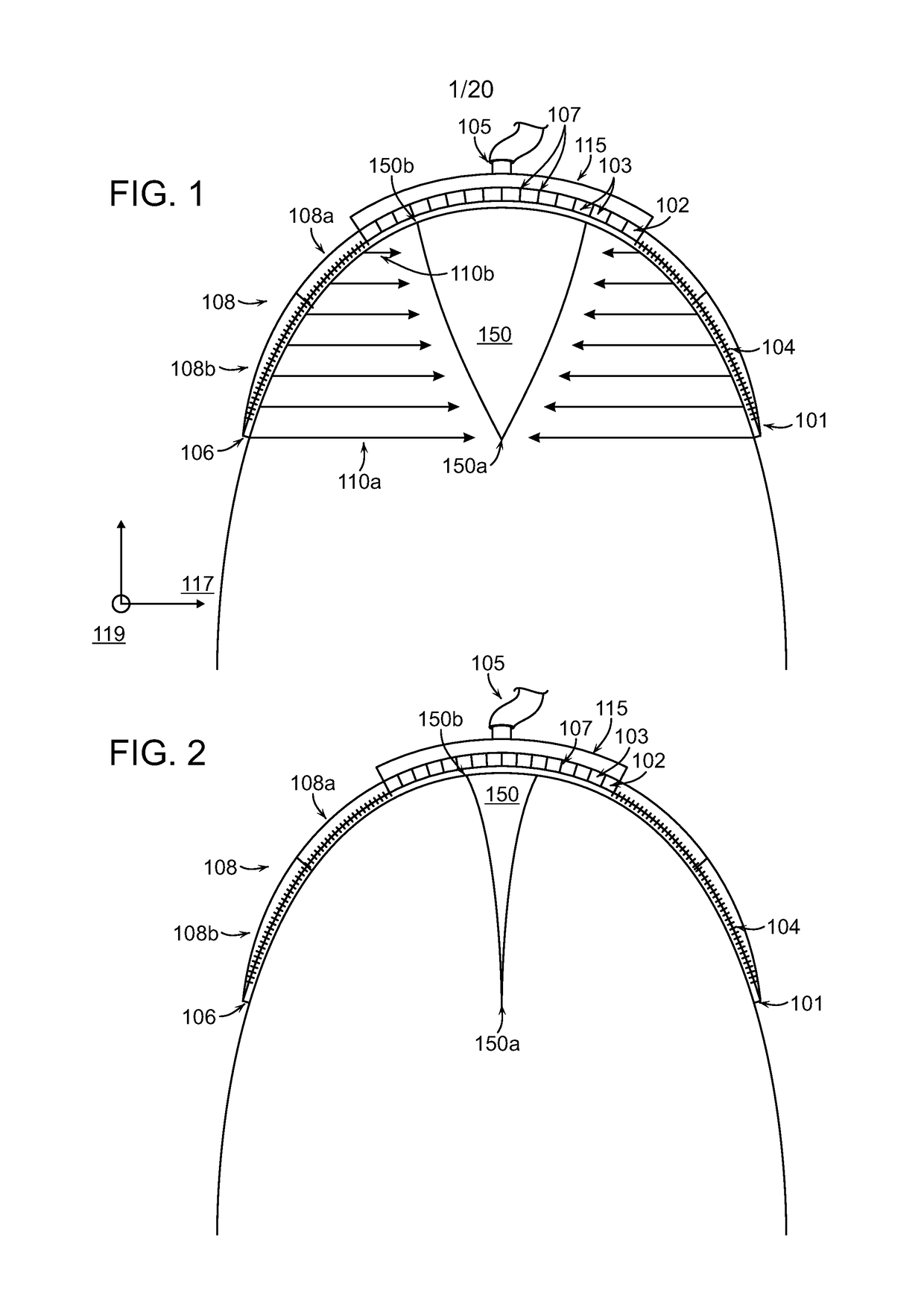 Negative pressure wound closure devices and methods