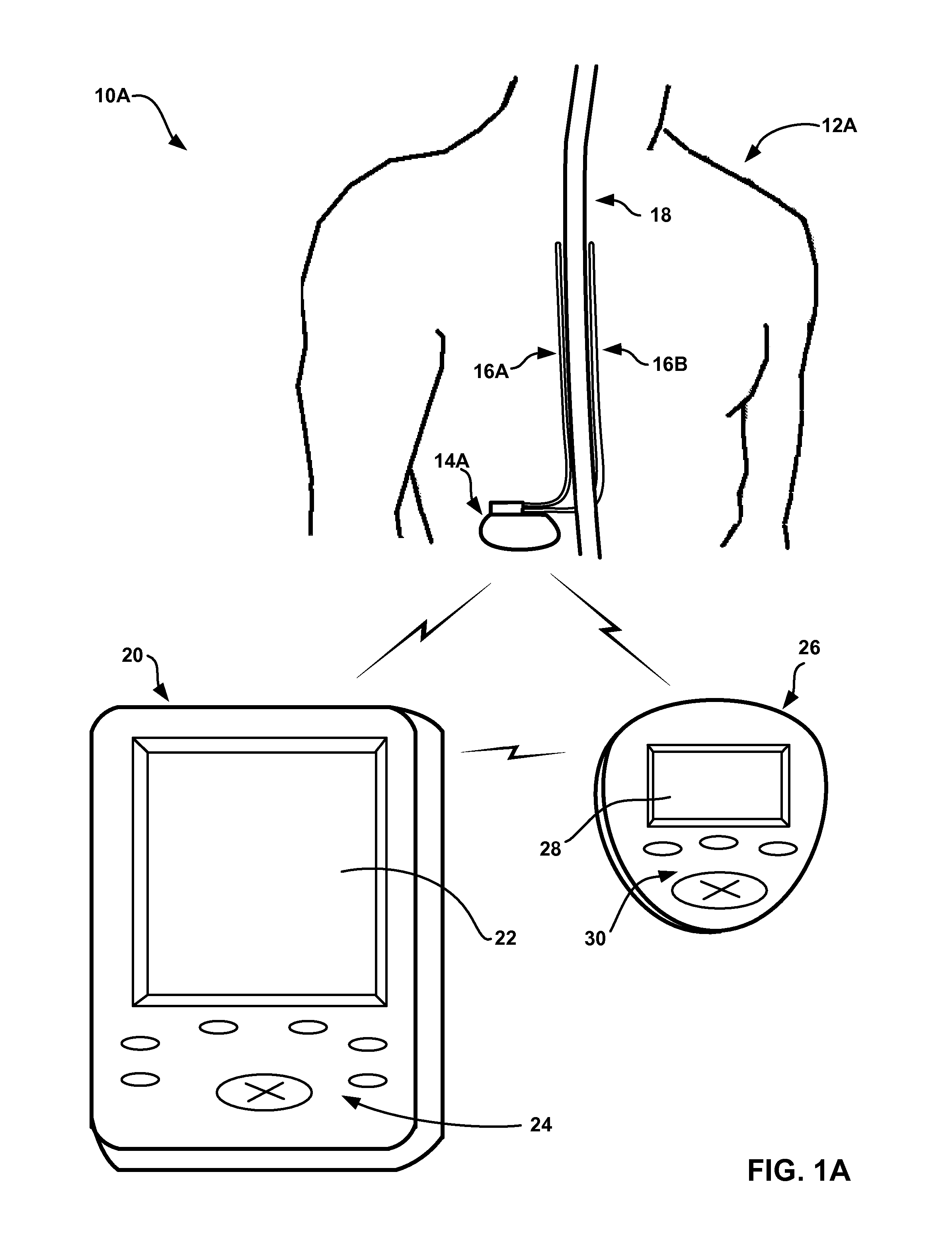 Collecting activity and sleep quality information via a medical device