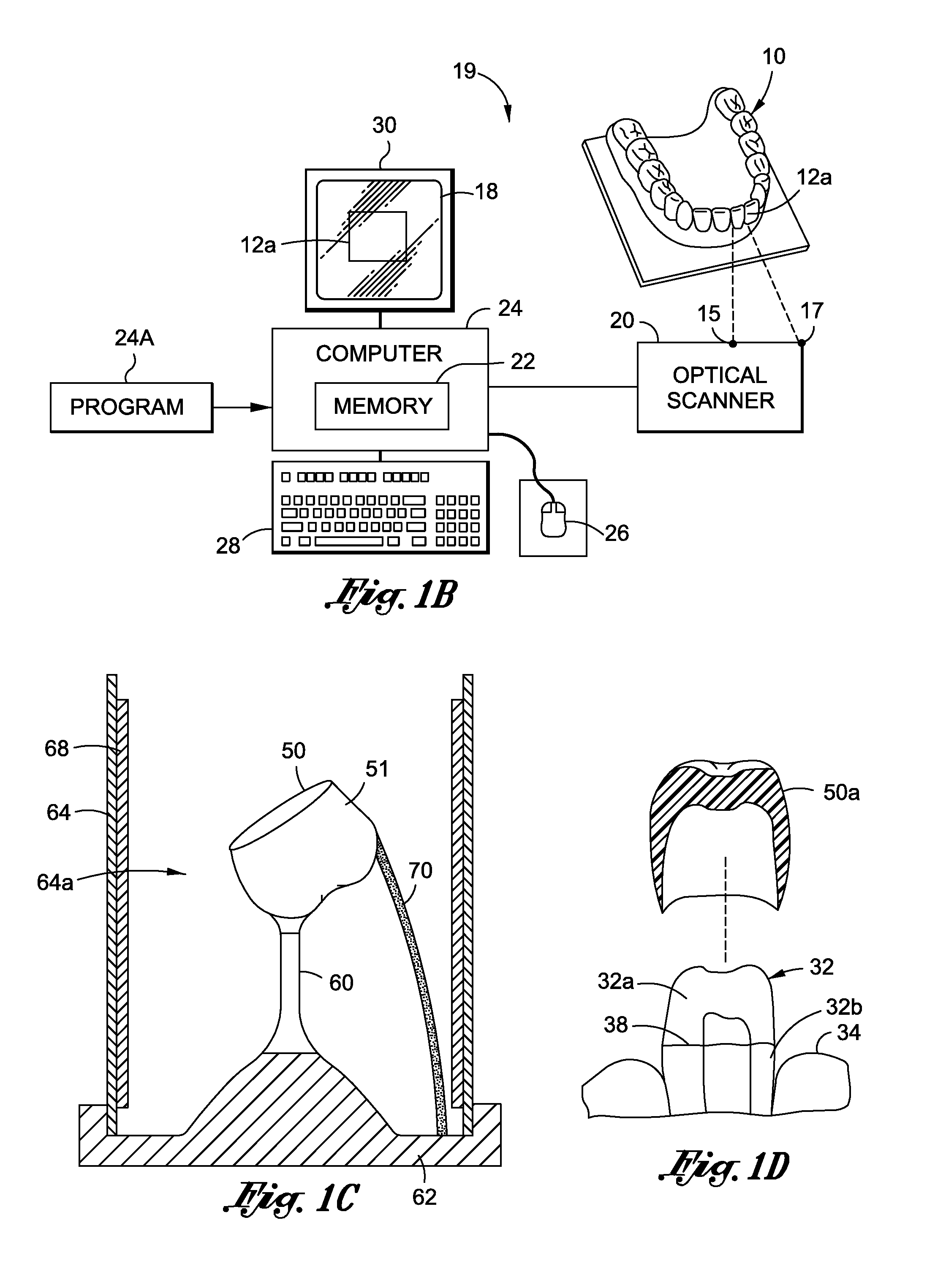 Jig device and apparatus and method of making a dental prosthesis or pattern therefor