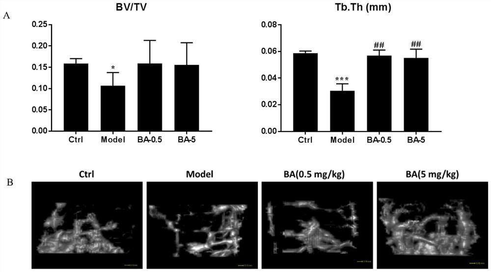 Application of brucetin a in the preparation of drugs for preventing and treating osteoporosis