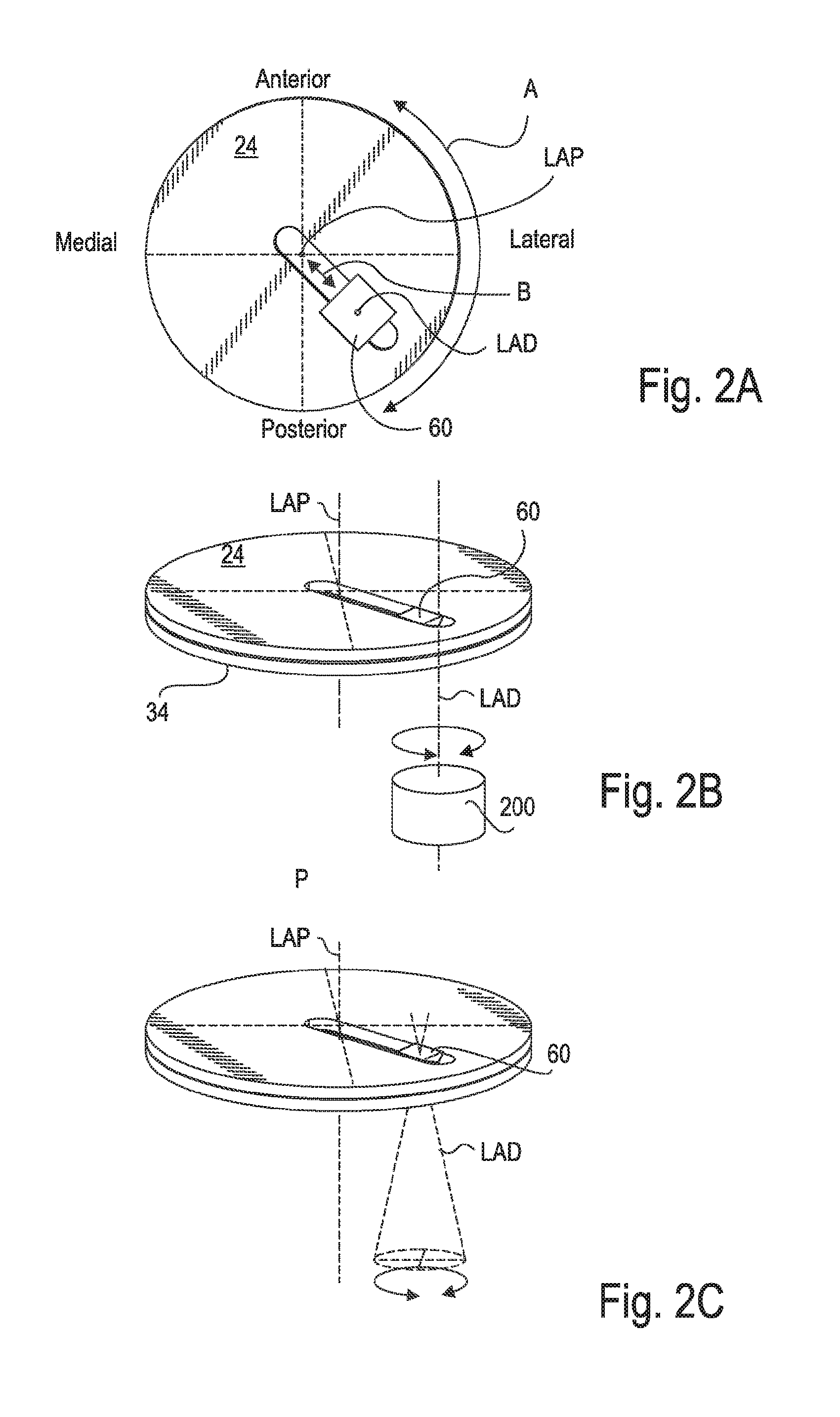 Alignable coupling assembly for connecting two prosthetic limb components