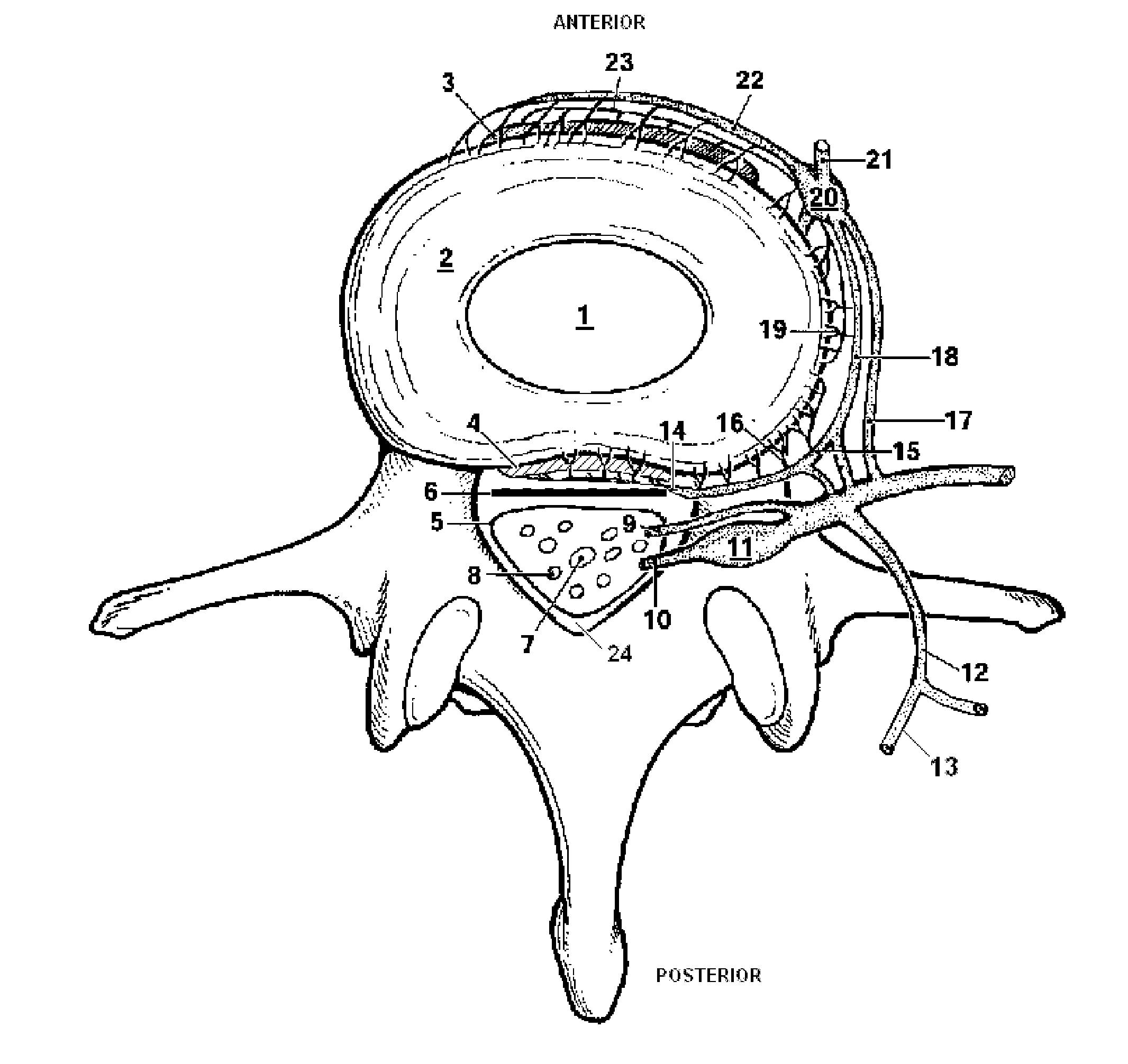 System and Method for Electrical Stimulation of the Lumbar Vertebral Column