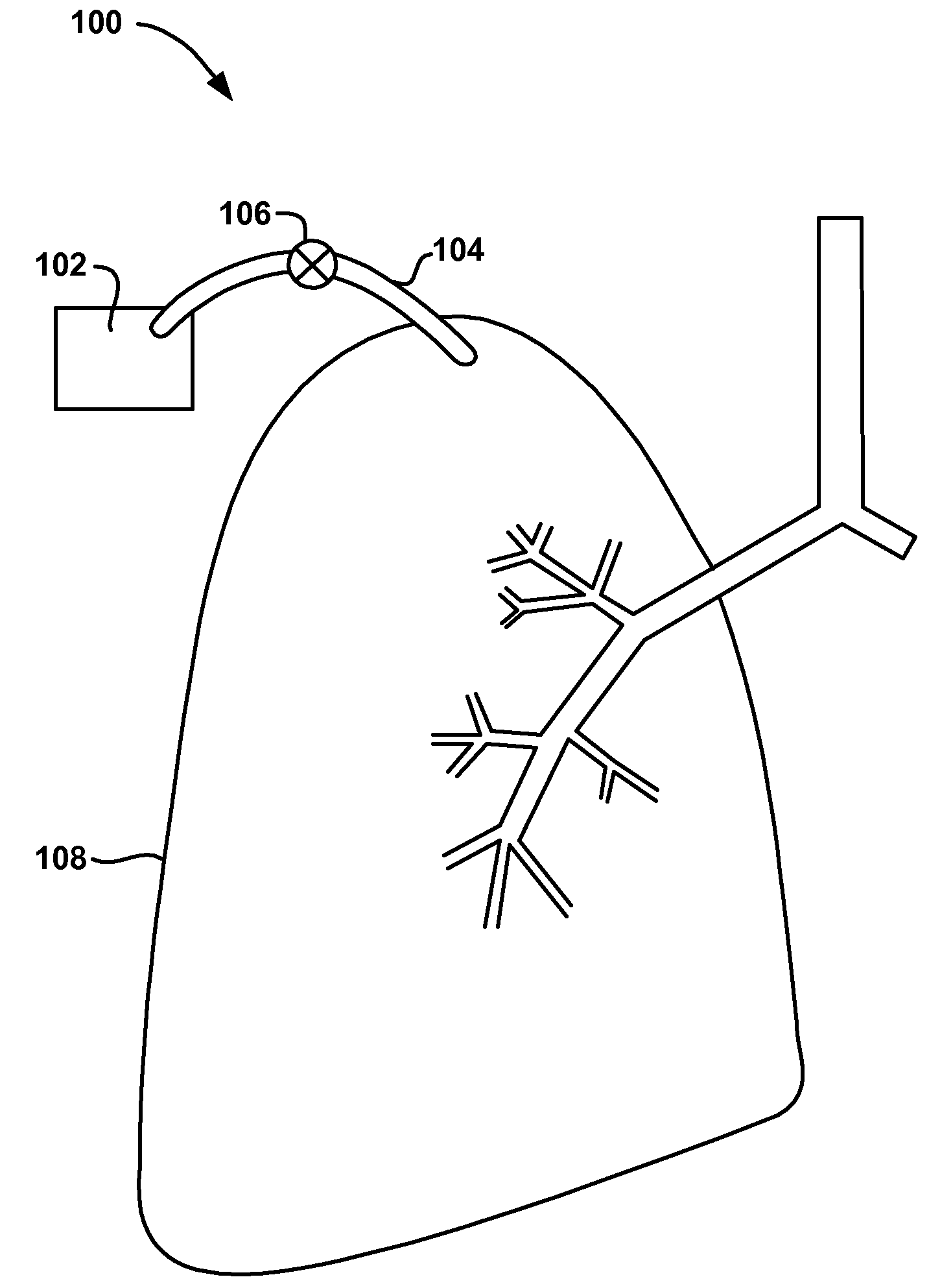 Methods and devices to maintain patency of a lumen in parenchymal tissue of the lung
