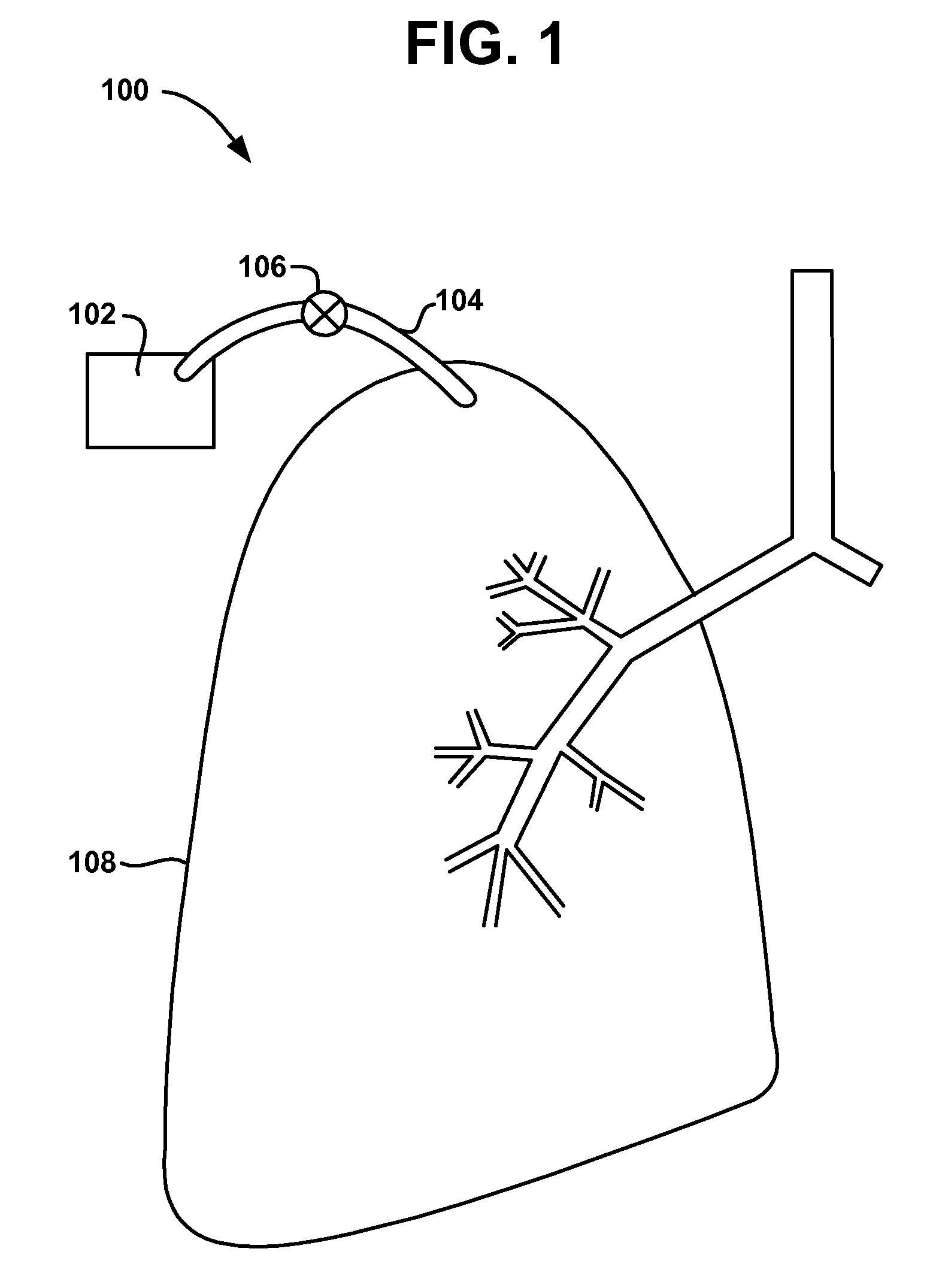 Methods and devices to maintain patency of a lumen in parenchymal tissue of the lung