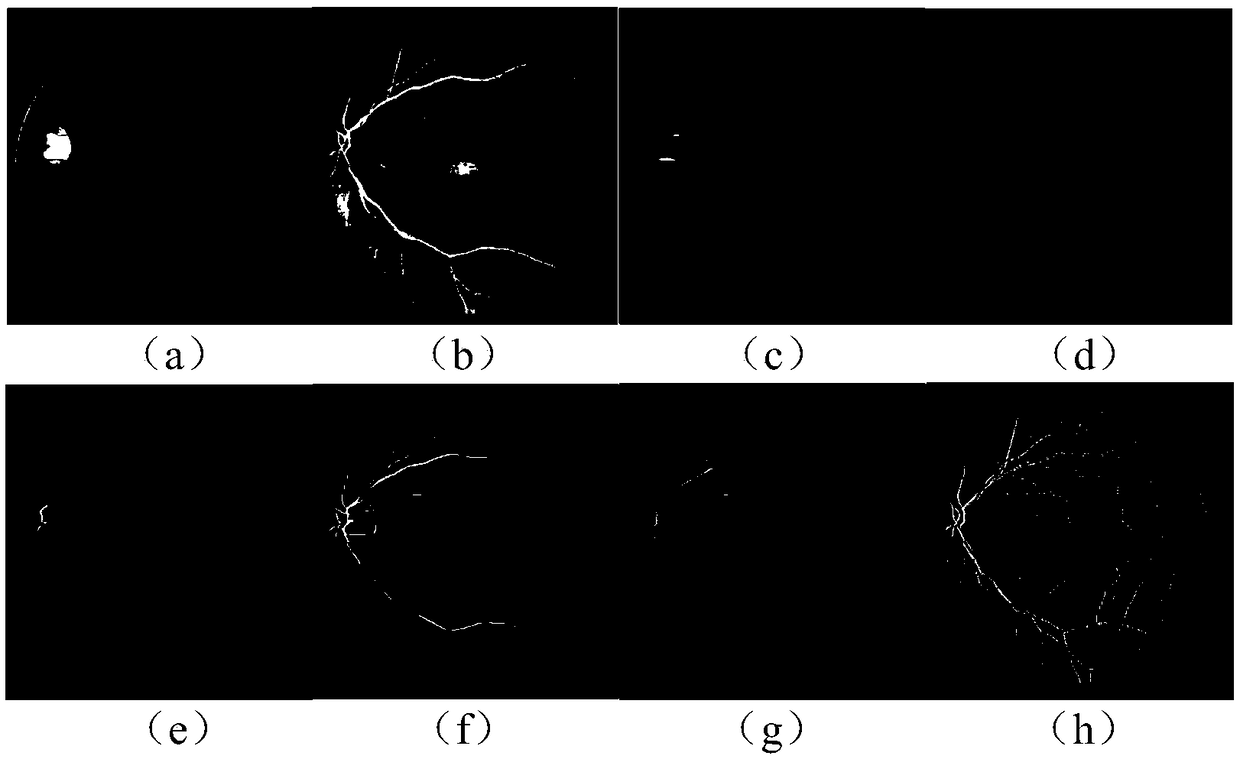 A fundus retinal blood vessel segmentation method and system based on K-Means clustering annotation and naive Bayesian model