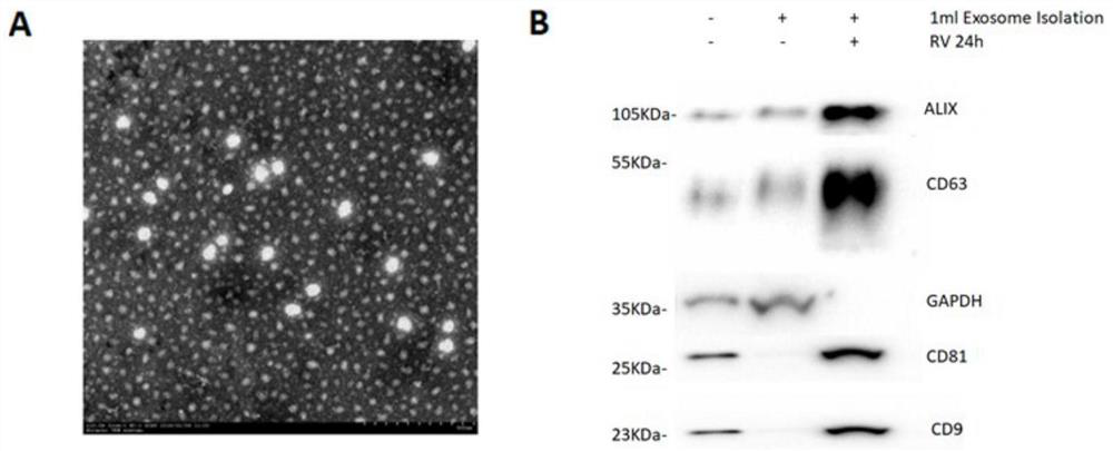 Exosome containing miR-135b-5p and application of exosome in rotavirus infection resistance