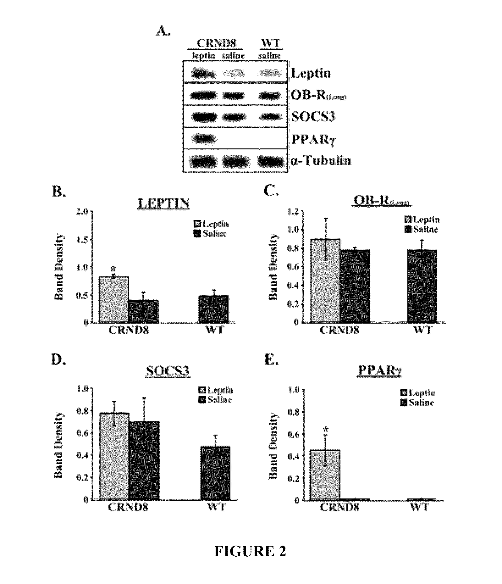 Leptin compositions and methods for treating progressive cognitive function disorders resulting from accumulation of neurofibrillary tangles and amyloid beta