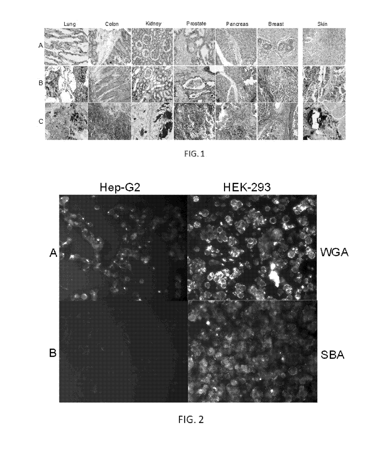 Saccharide-based biomarkers and therapeutics