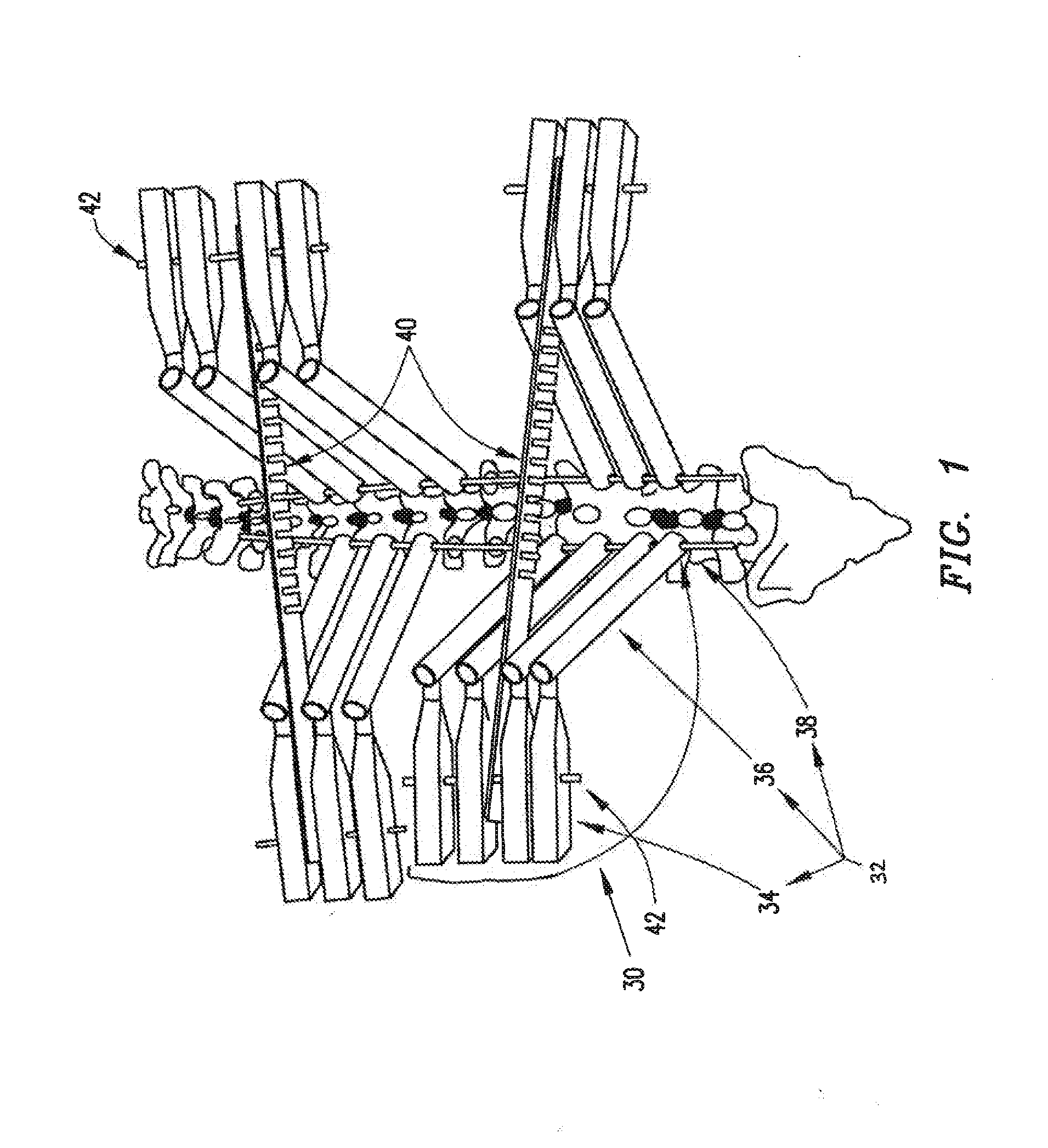 System and method for aligning vertebrae in the amelioration of aberrant spinal column deviation conditions