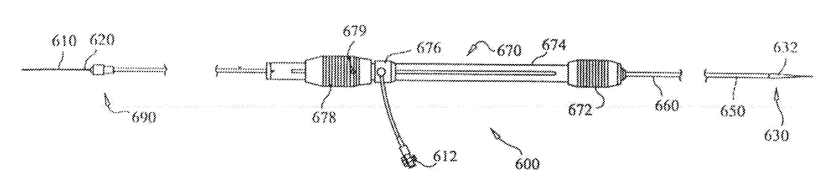 Method for Operating a Stent Graft Delivery System Handle