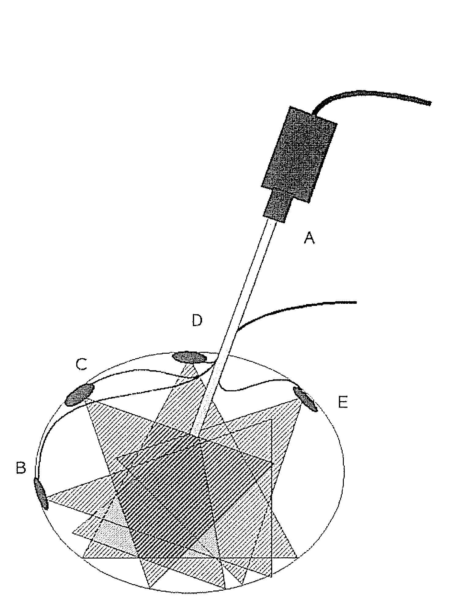 Endoscopic vision system