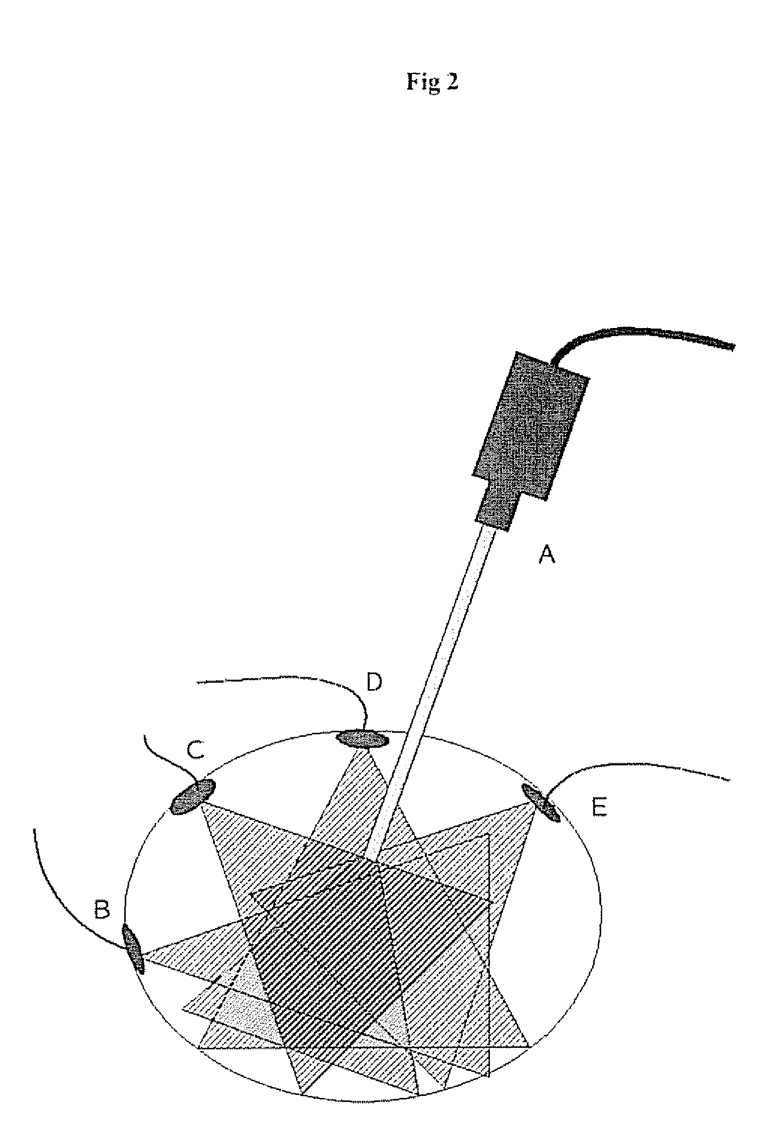 Endoscopic vision system