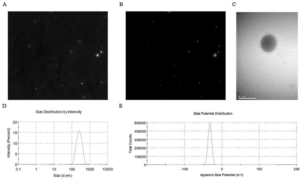 Lipopolysaccharide/indocyanine green/oxaliplatin nanoparticles and preparation method thereof