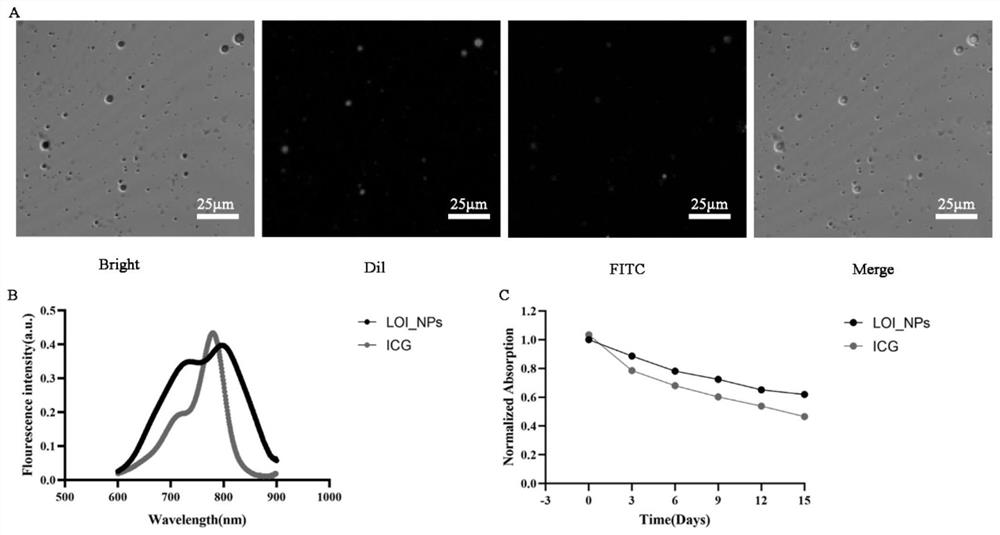 Lipopolysaccharide/indocyanine green/oxaliplatin nanoparticles and preparation method thereof