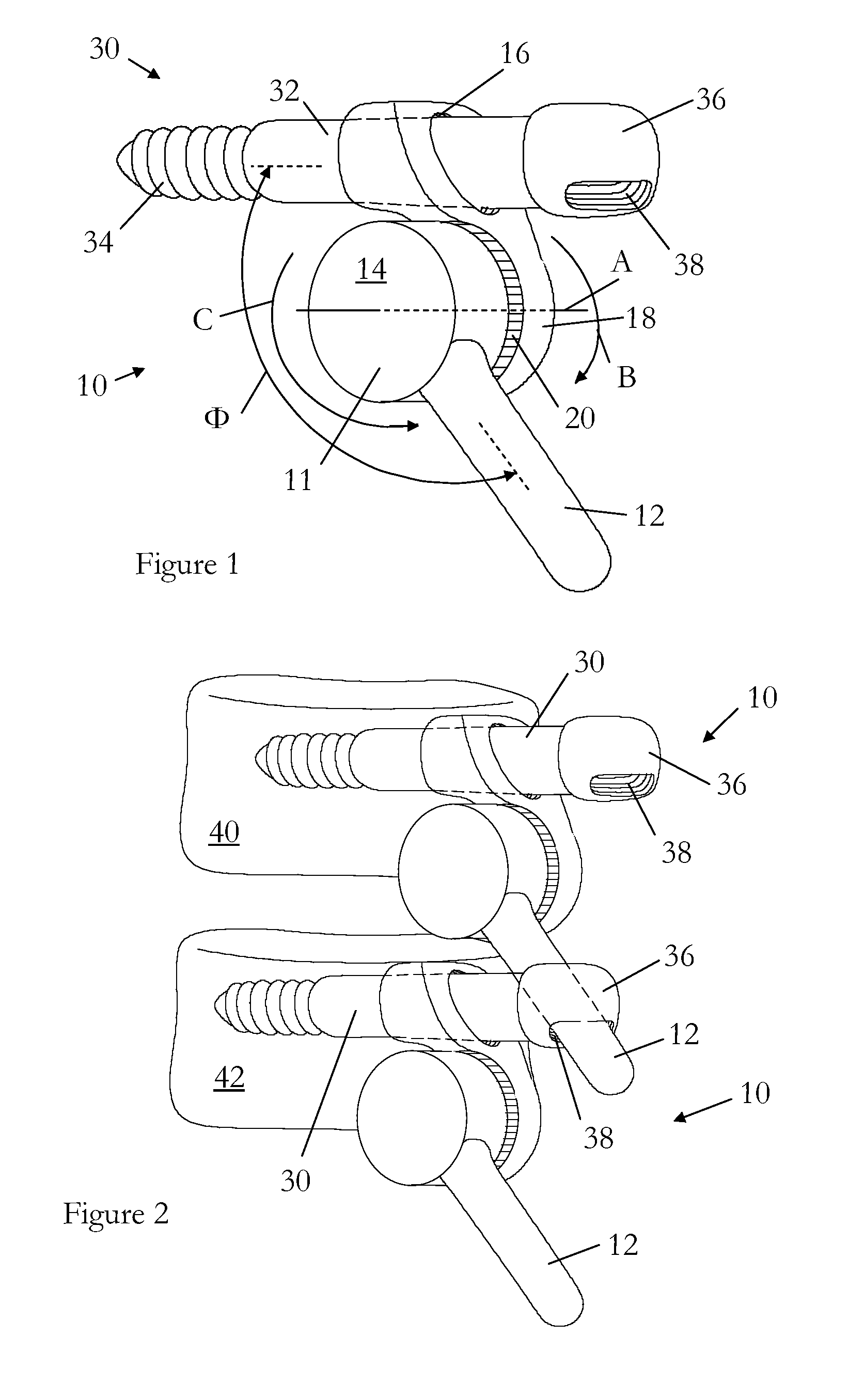 Surgical device for correction of spinal deformities