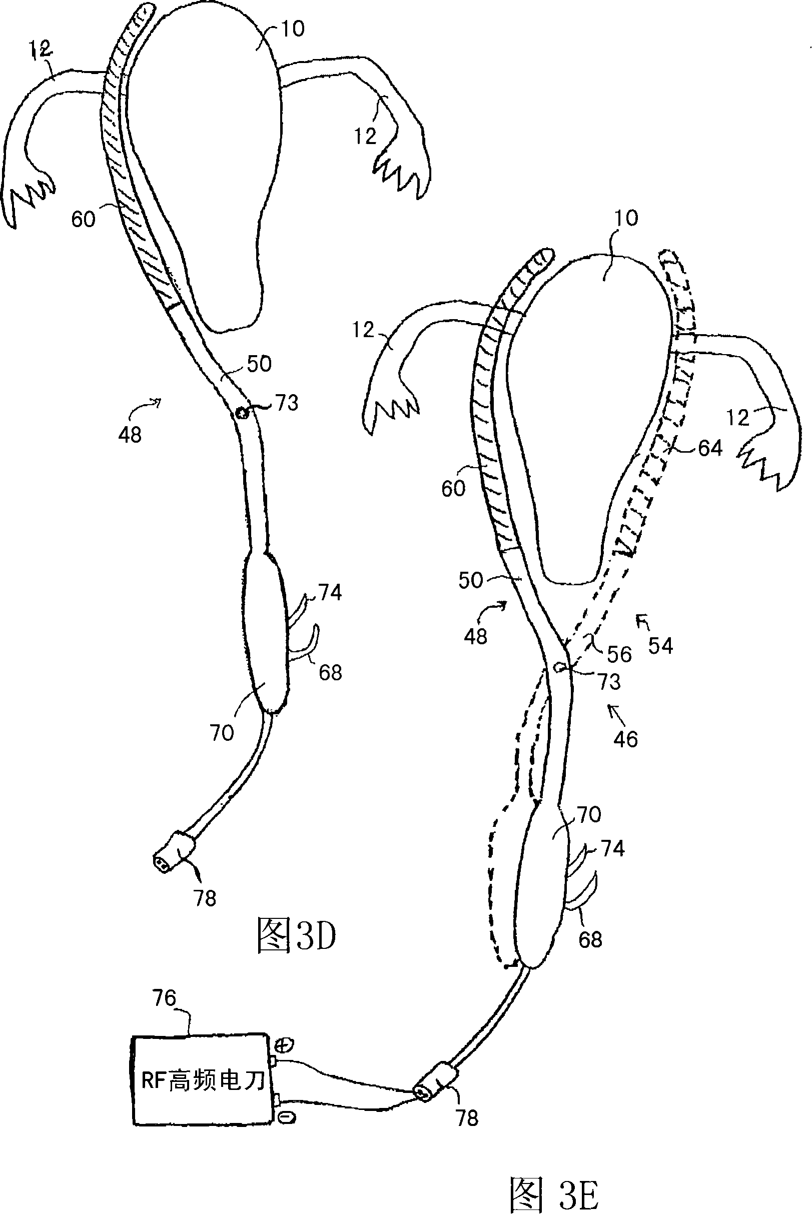 Method and apparatus for performing a surgical procedure