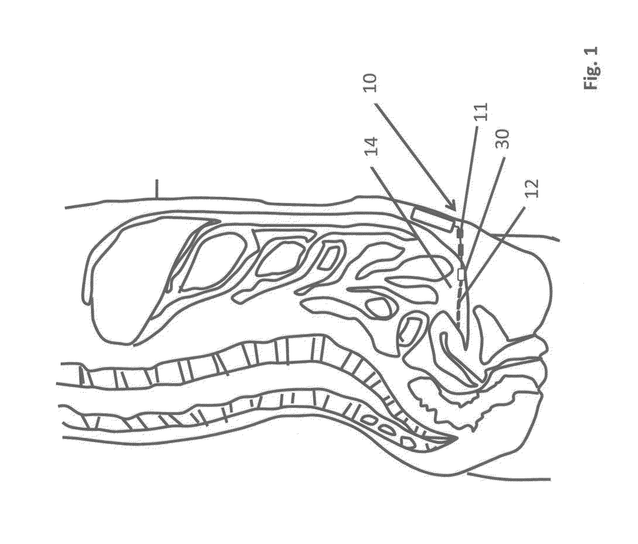 Methods and devices for the diagnosis and treatment of diabetes