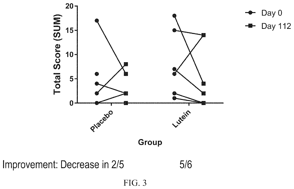 Methods of protecting the eye health of children exposed to blue and white light