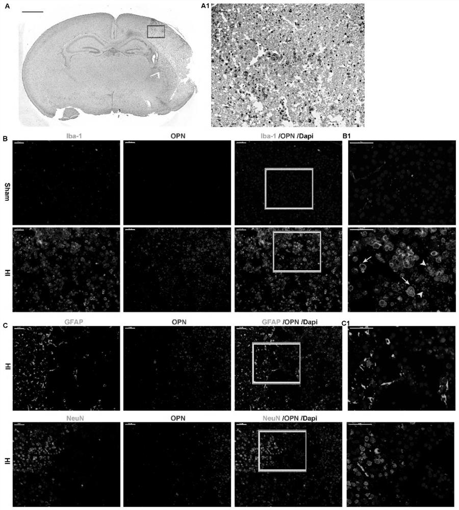 Application of osteopontin in hypoxic-ischemic brain injury