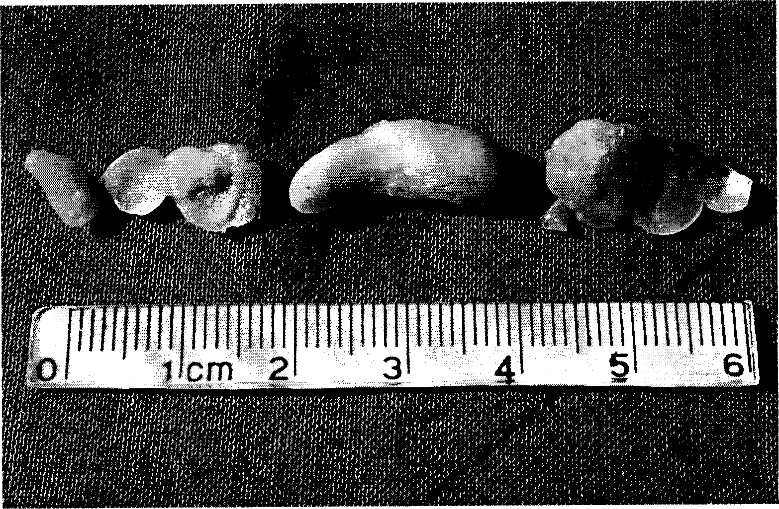 Allogenic tissue engineered cartilage and its application