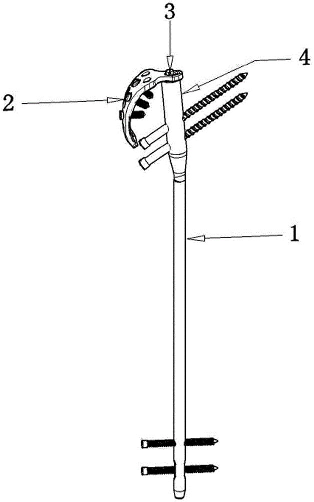 Internal fixing system for femoral trochanter nail plate