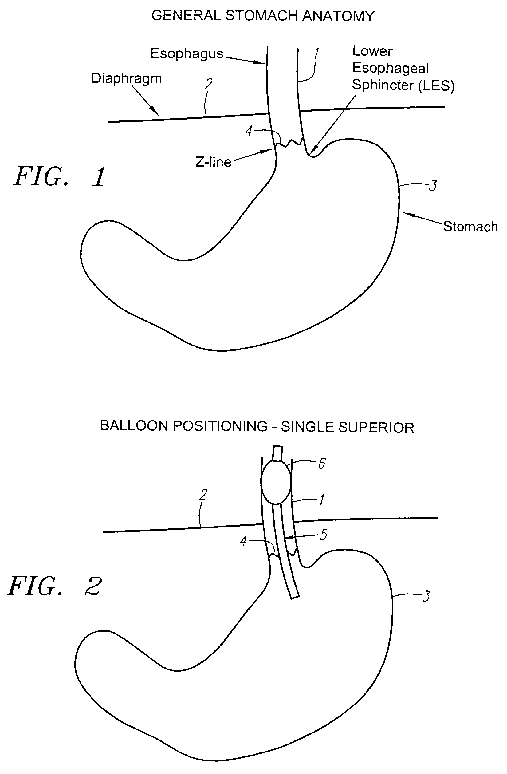 Methods and apparatus for testing disruption of a vagal nerve