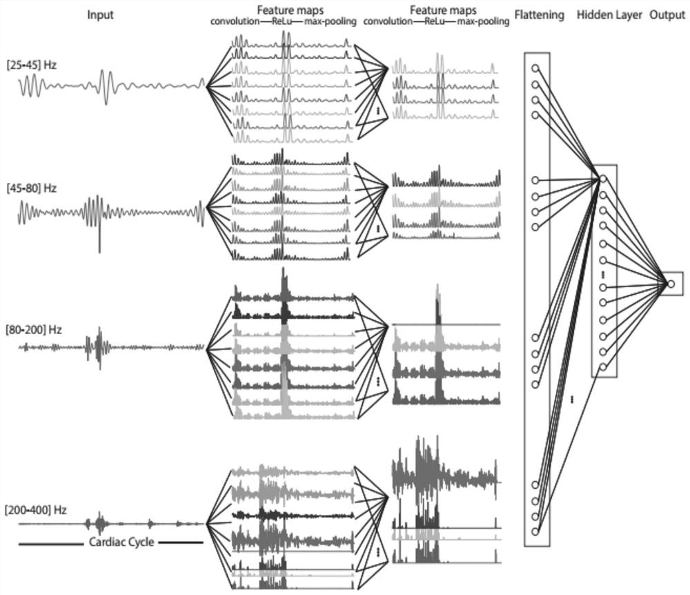 Auxiliary electronic stethoscope signal discrimination method based on deep learning