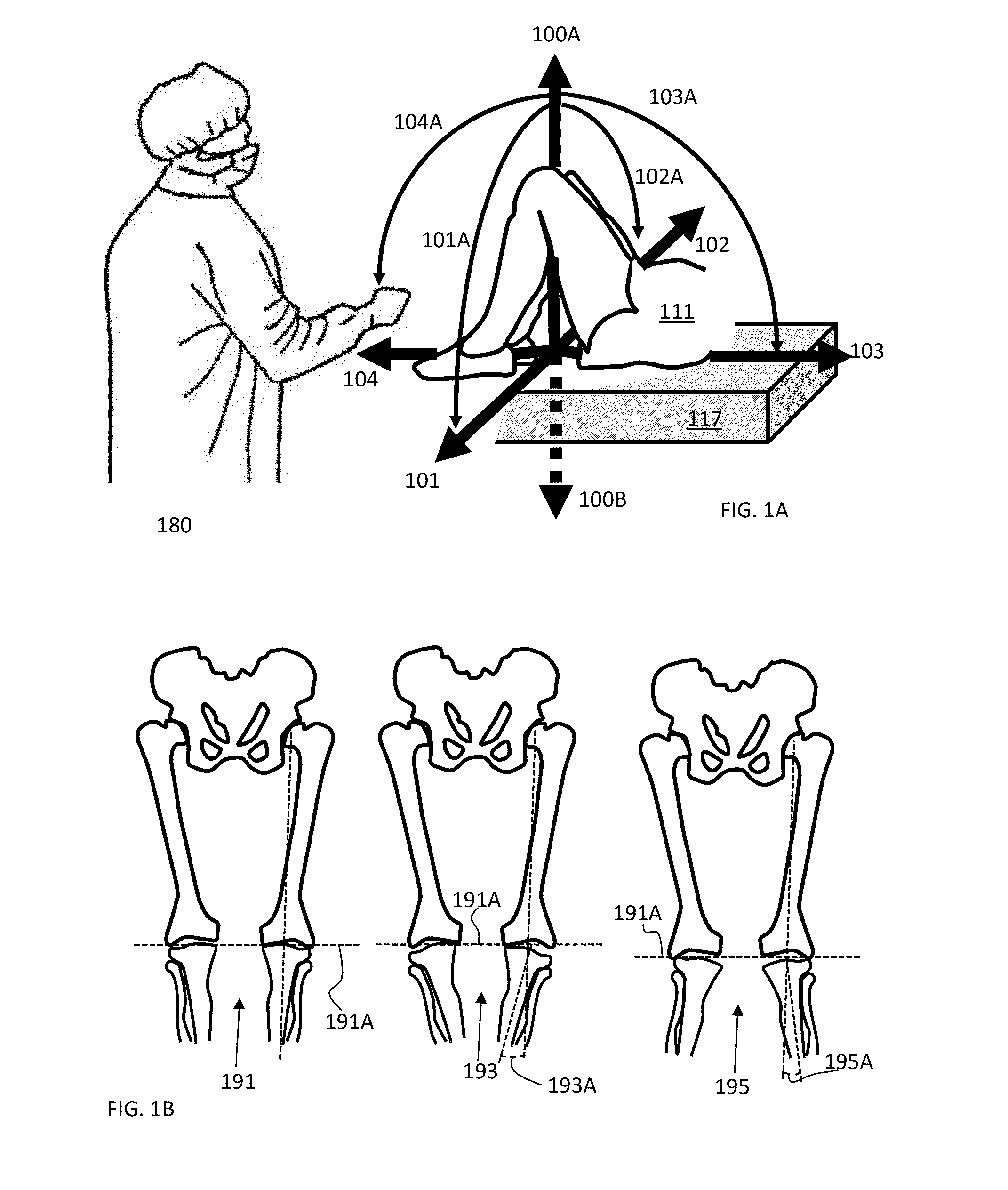 System and method for measuring slope or tilt of a bone cut on the muscular-skeletal system
