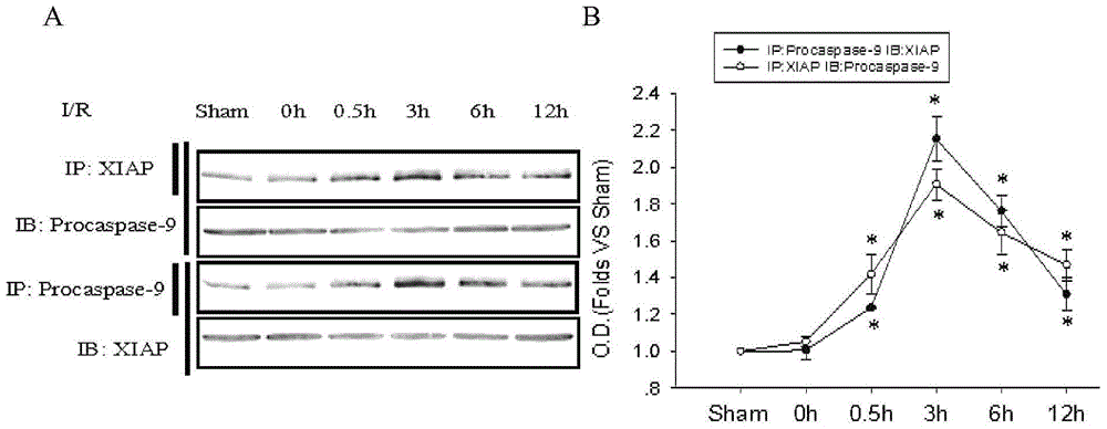 Small peptide TAT-AVPY for treating ischemic brain damage, and application thereof