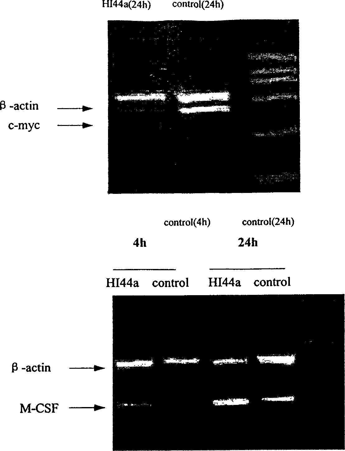 Engineering antibody against CD44 for inducing leukemia cell differentation and necrosis